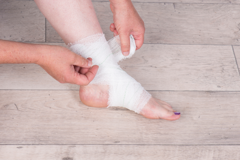 How to Treat an Injured Ankle or Ankle Sprain 