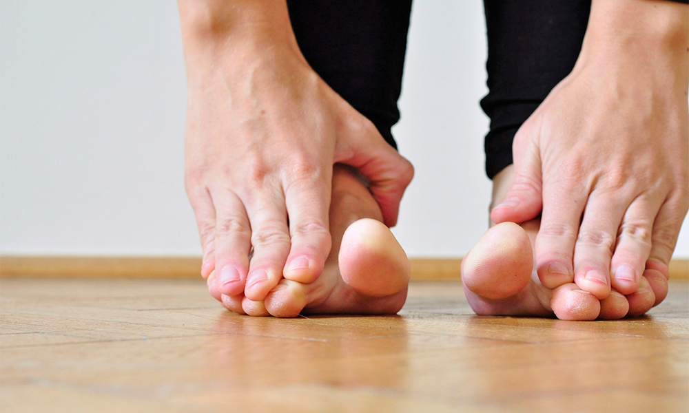Splay Foot Symptoms And Treatment Exercises