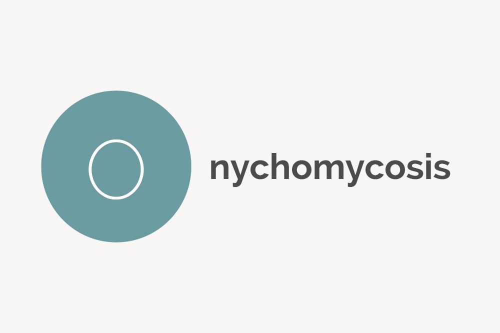 Onychomycosis Definition 