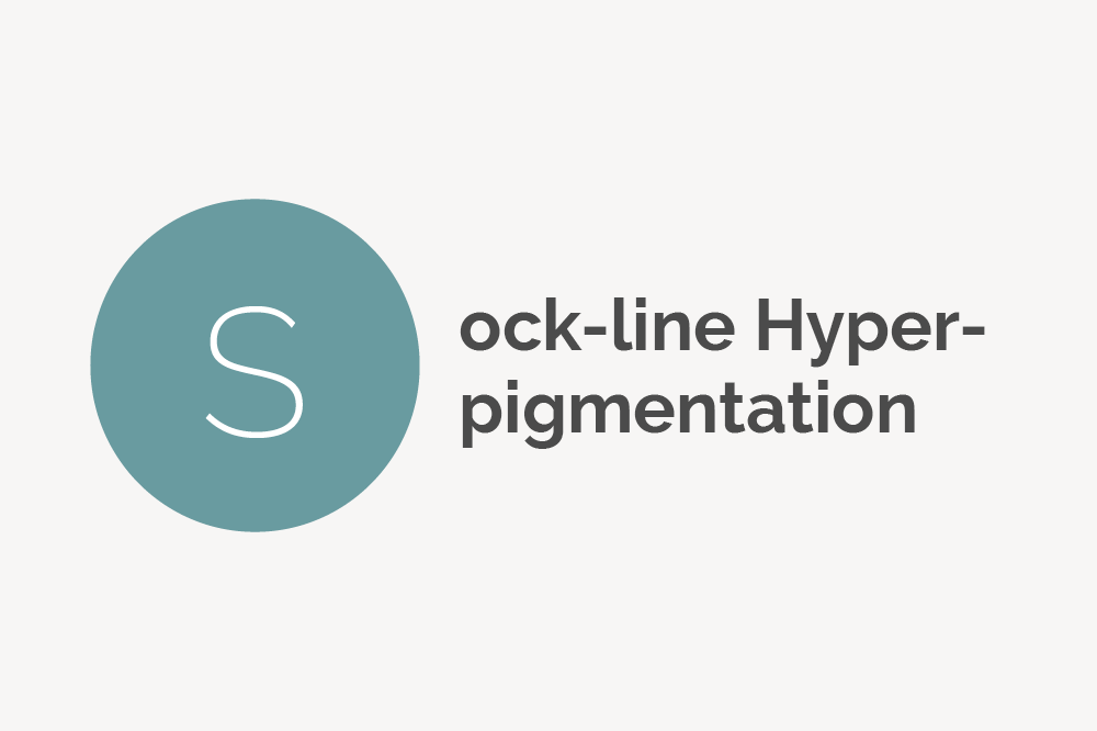 Sock-Line Hyperpigmentation Definition 